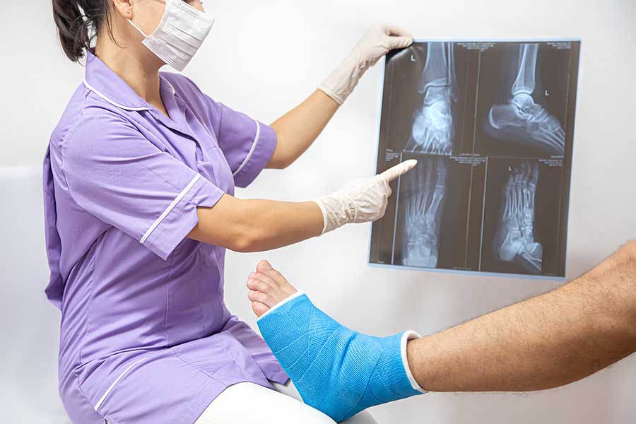Multiple fracture injury claim, doctor checking broken leg and shows the male patient lateral projection x-ray of foot and ankle